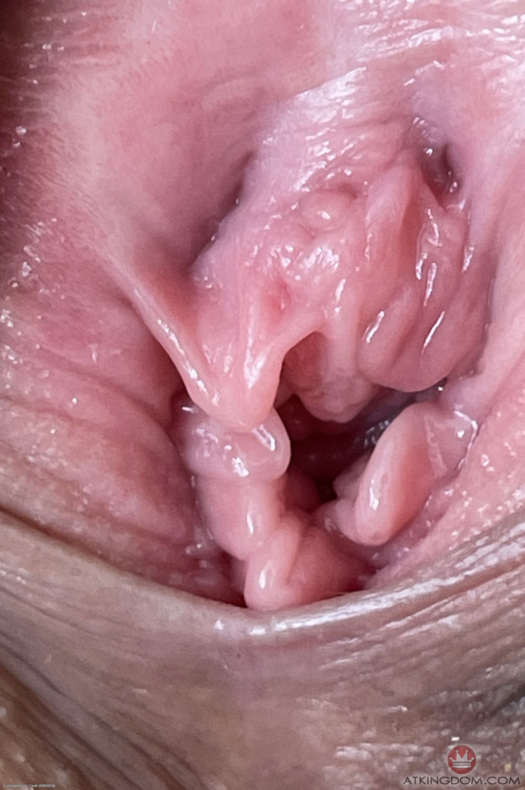 Click here for next image